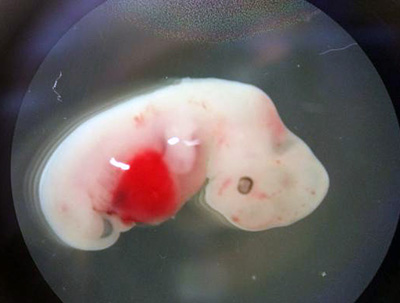 Embrión humano-cerdo