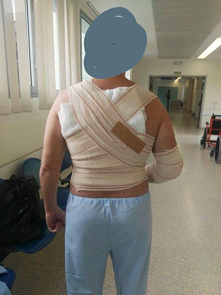 Guardia Civil gravemente herido por ataque de los inmigrantes en Ceuta